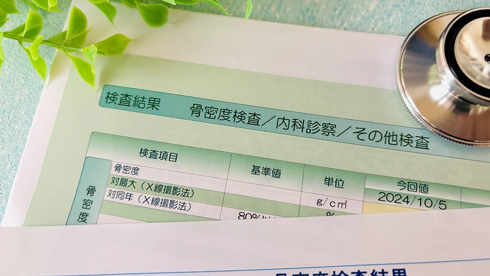 骨密度検診結果のイメージ